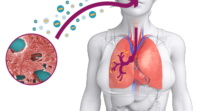 infezione-legionella-respirazione-problemi