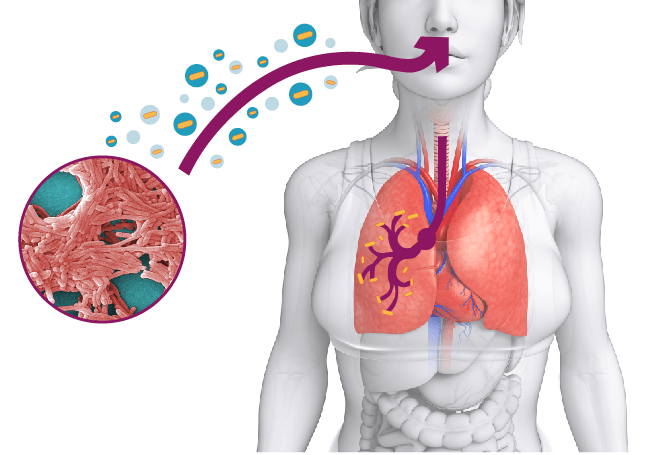 infezione-legionella-respirazione-problemi